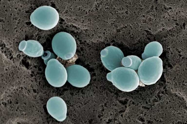 Vonesch lab yeast